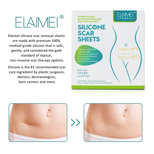 ELAIMEI Medical Soft Silicone Gel Tape for Scar Removal