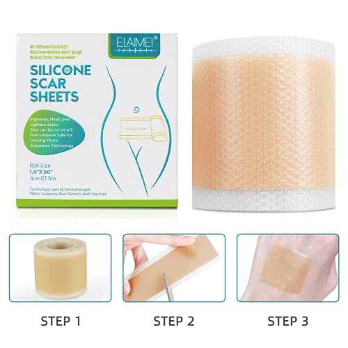 ELAIMEI Medical Soft Silicone Gel Tape for Scar Removal