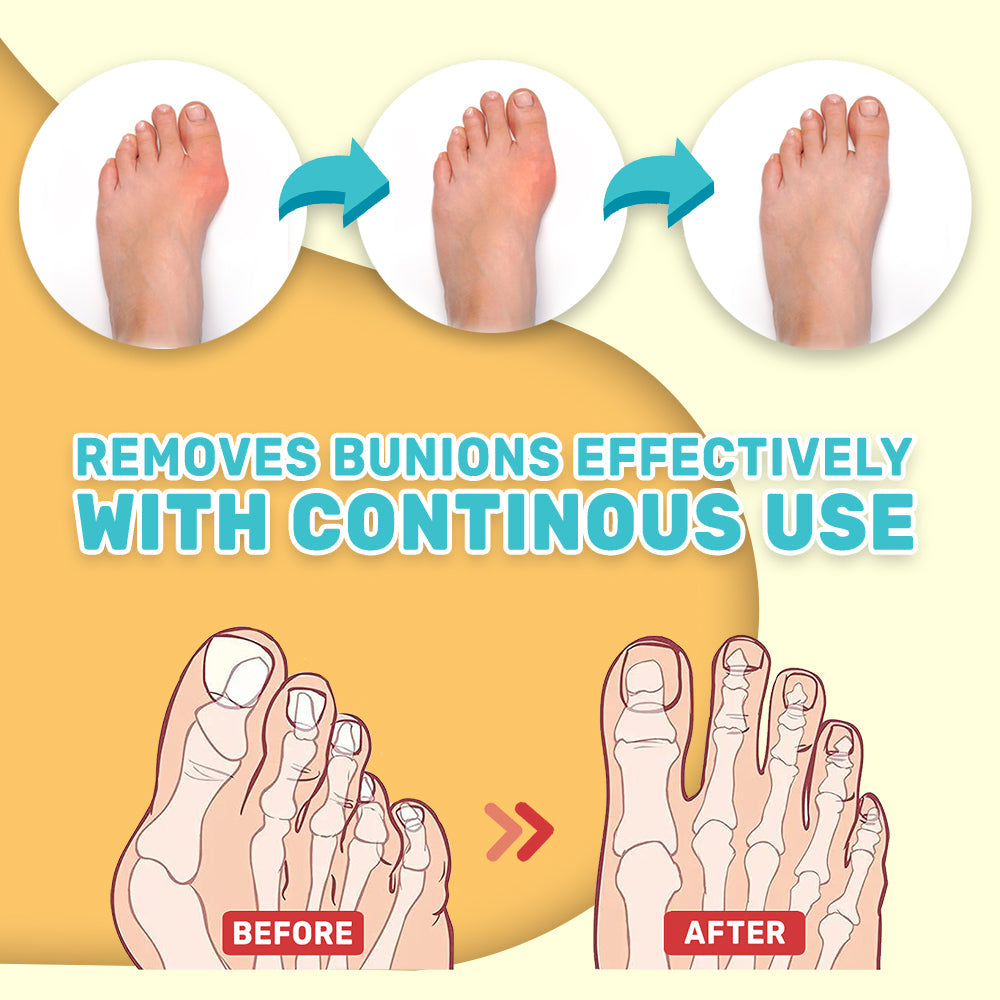 FNB Bunion Toe Stiffness Relief Cream