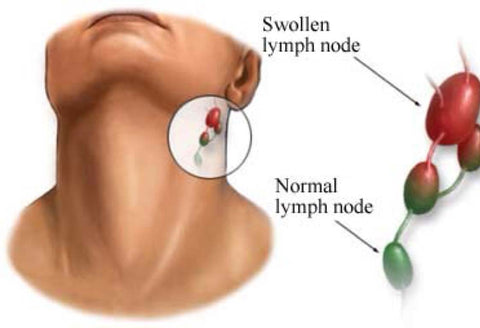 Herbal Lymph Clearing Patch